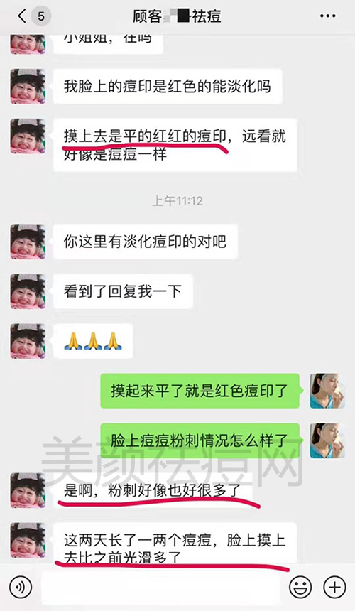 中药祛痘有用吗 中药祛痘效果好不好