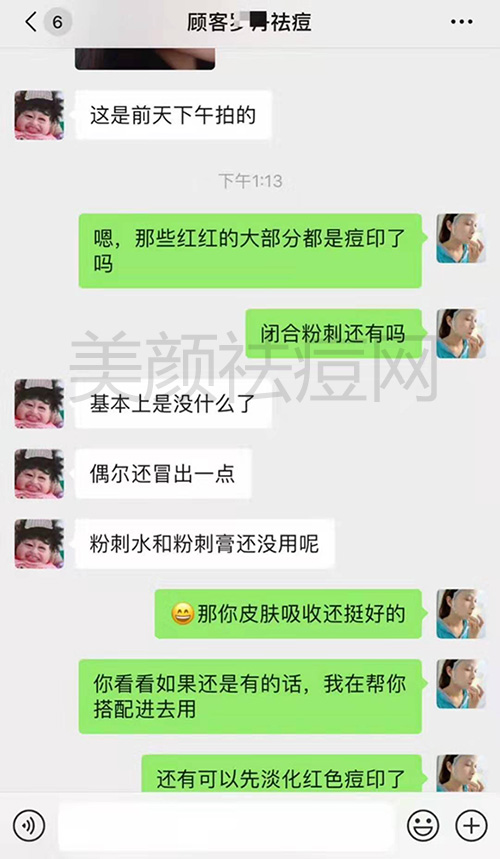 中药祛痘有用吗 中药祛痘效果好不好