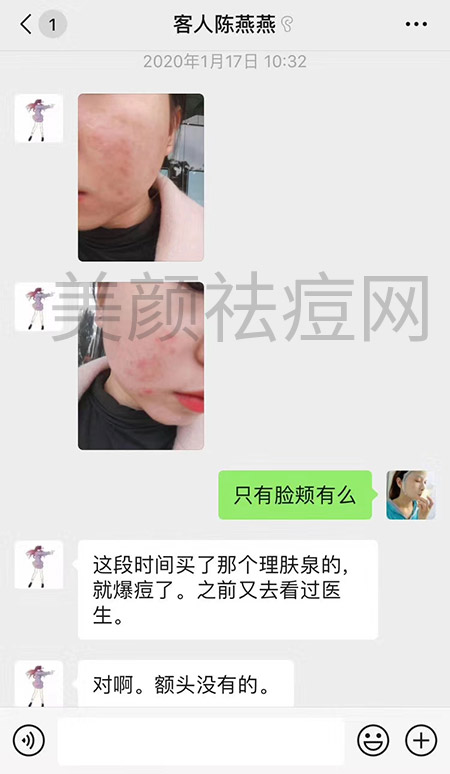 反馈效果1