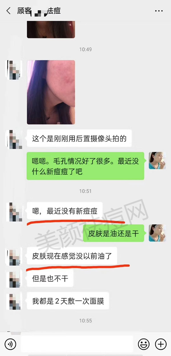 脸上老是长囊肿型痘痘怎么办