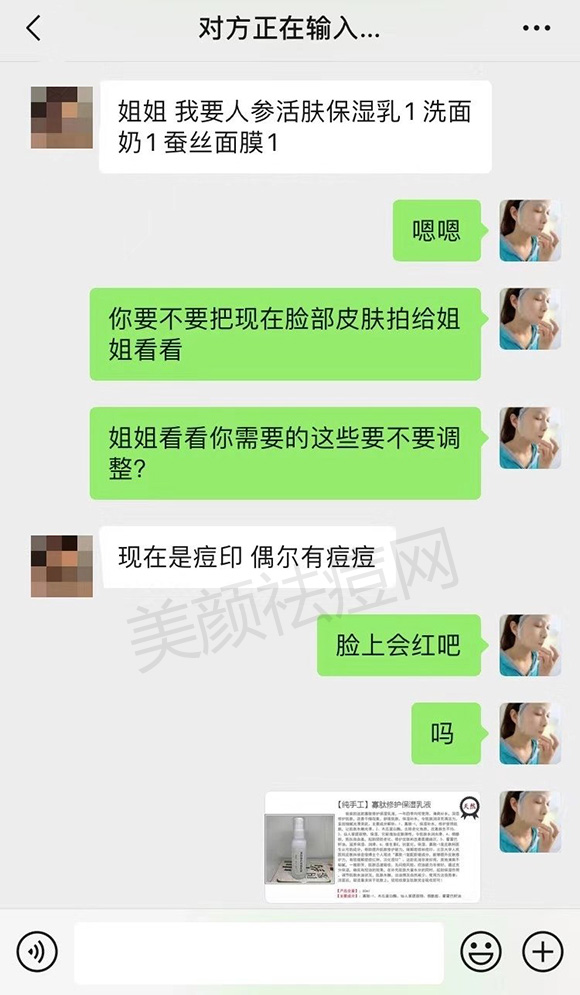 面部囊肿型痘痘怎么治