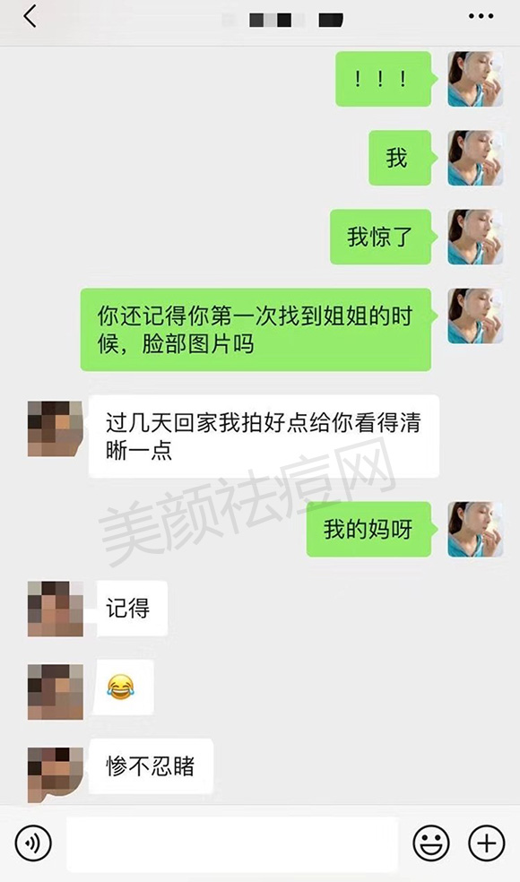 囊肿型痘痘除根反馈1